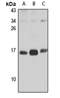 Anti-UQCC2 Antibody