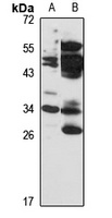 USB1 antibody