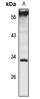 USE1 antibody