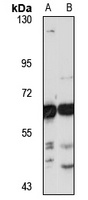 USP14 antibody