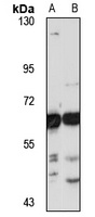 Anti-USP14 Antibody