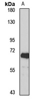 Anti-USP21 Antibody