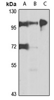 Anti-UVRAG Antibody