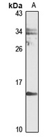 Anti-UXT Antibody