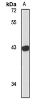 Anti-VAT1 Antibody