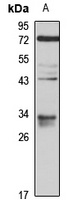 VDAC3 antibody