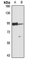 Anti-VEPH1 Antibody