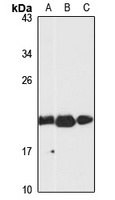 Anti-VPS25 Antibody