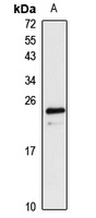 Anti-VPS29 Antibody