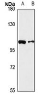 Anti-VPS39 Antibody