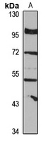 VRK2 antibody