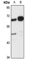 Anti-VSIG1 Antibody