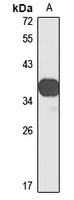 Anti-VSX1 Antibody