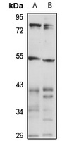 Anti-WARS2 Antibody