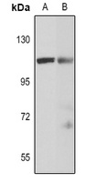 WBP11 antibody