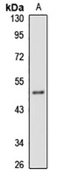 Anti-WDFY2 Antibody