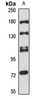 WDR35 antibody