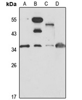 WDR61 antibody