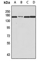NSD3 antibody