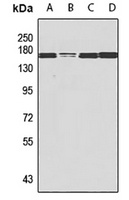 Anti-NSD3 Antibody