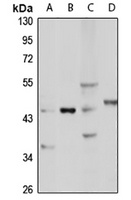 Anti-WISP1 Antibody