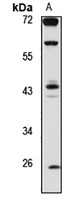Anti-WNT10B Antibody