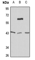 Wnt-5a antibody