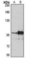 Anti-HCNP Antibody