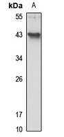 YOD1 antibody