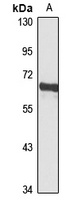 YTHDF3 antibody