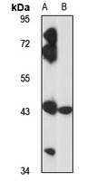 ZCCHC3 antibody