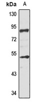 Anti-ZFYVE1 Antibody