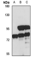 Anti-ZNF182 Antibody