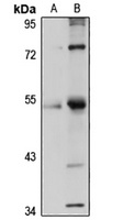ZNF3 antibody