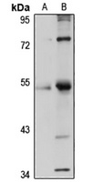 Anti-ZNF3 Antibody