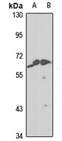 Anti-ZNF350 Antibody