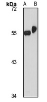 ZNF563 antibody