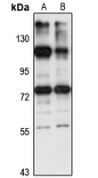 ZNF598 antibody