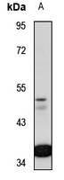 ZNF701 antibody
