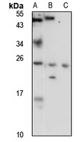 Anti-ZNRF1 Antibody