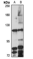 ZNRF3 antibody