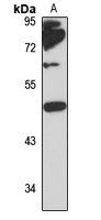 ZP3 antibody