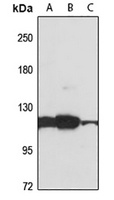 ZRANB3 antibody