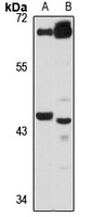 Anti-ZSCAN4 Antibody