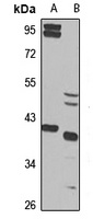 Anti-ZWINT Antibody