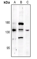 PERK (phospho-T981) antibody