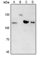 beta Amyloid antibody