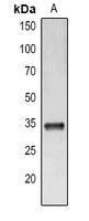 Anti-IL-33 Antibody