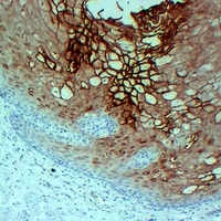 Anti-Annexin A1 Antibody