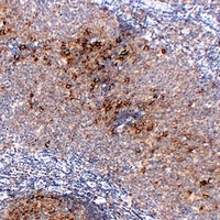 Anti-CD23 Antibody